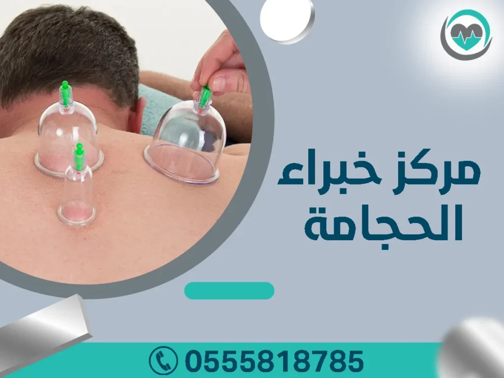 مركز حجامة بالرياض