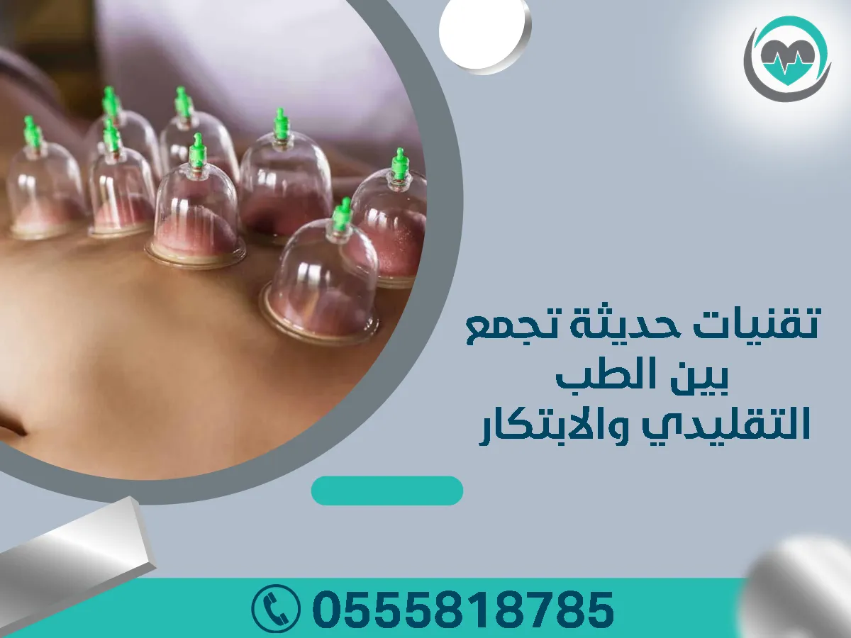 تقنيات حديثة تجمع بين الطب التقليدي والابتكار في الحجامة