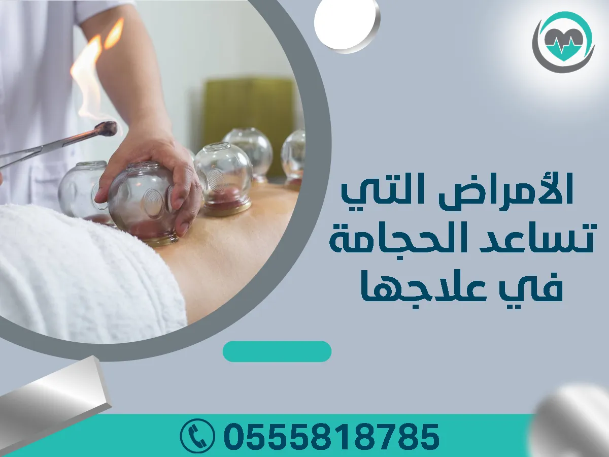 الأمراض التي تساعد الحجامة في علاجها