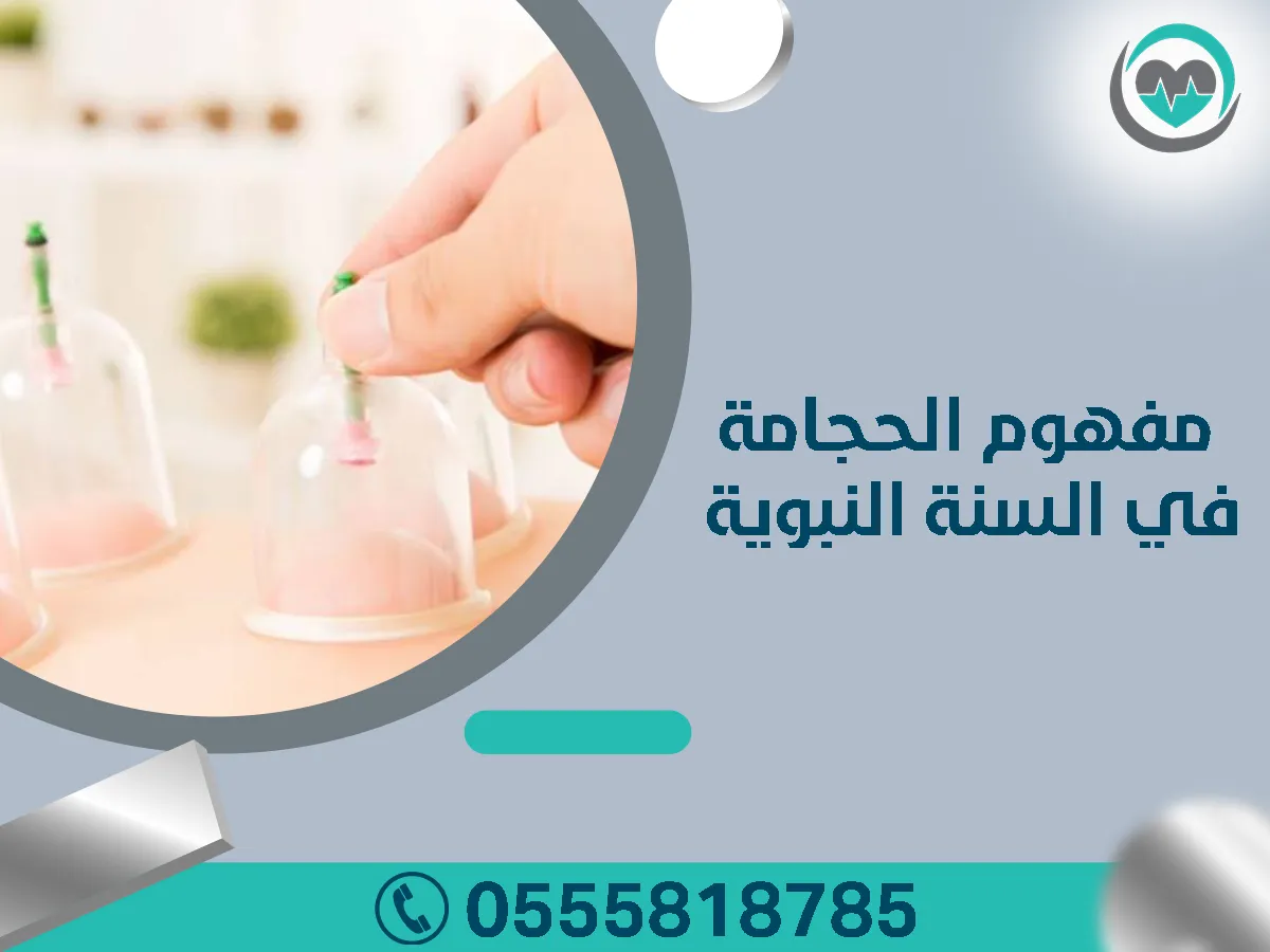 مفهوم الحجامة في السنة النبوية