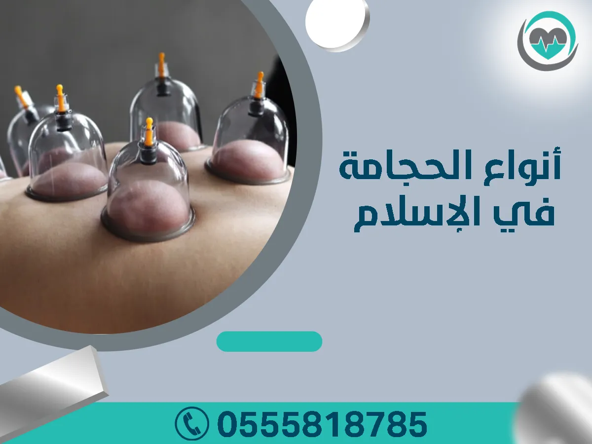 أنواع الحجامة في الإسلام