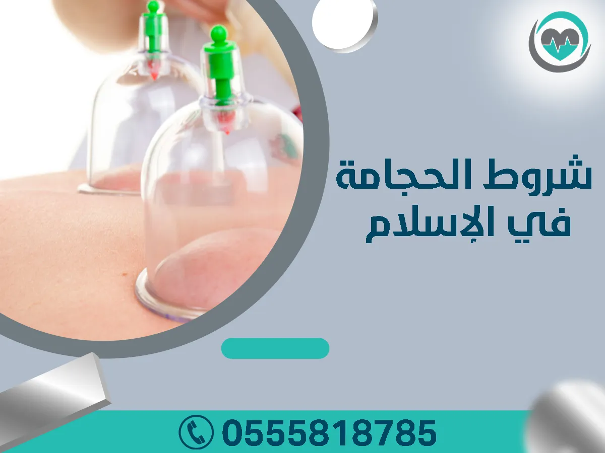 شروط الحجامة في الإسلام
