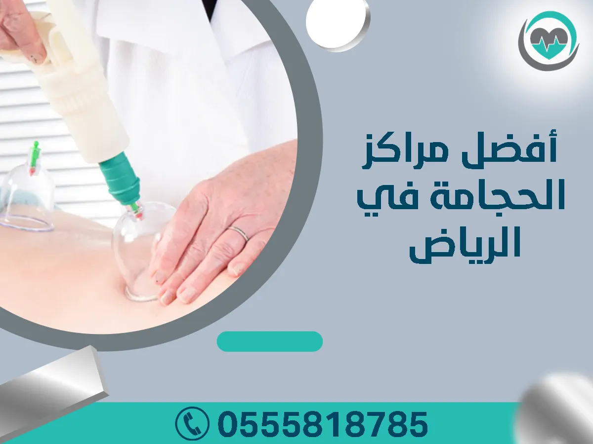 افضل مراكز الحجامة في الرياض