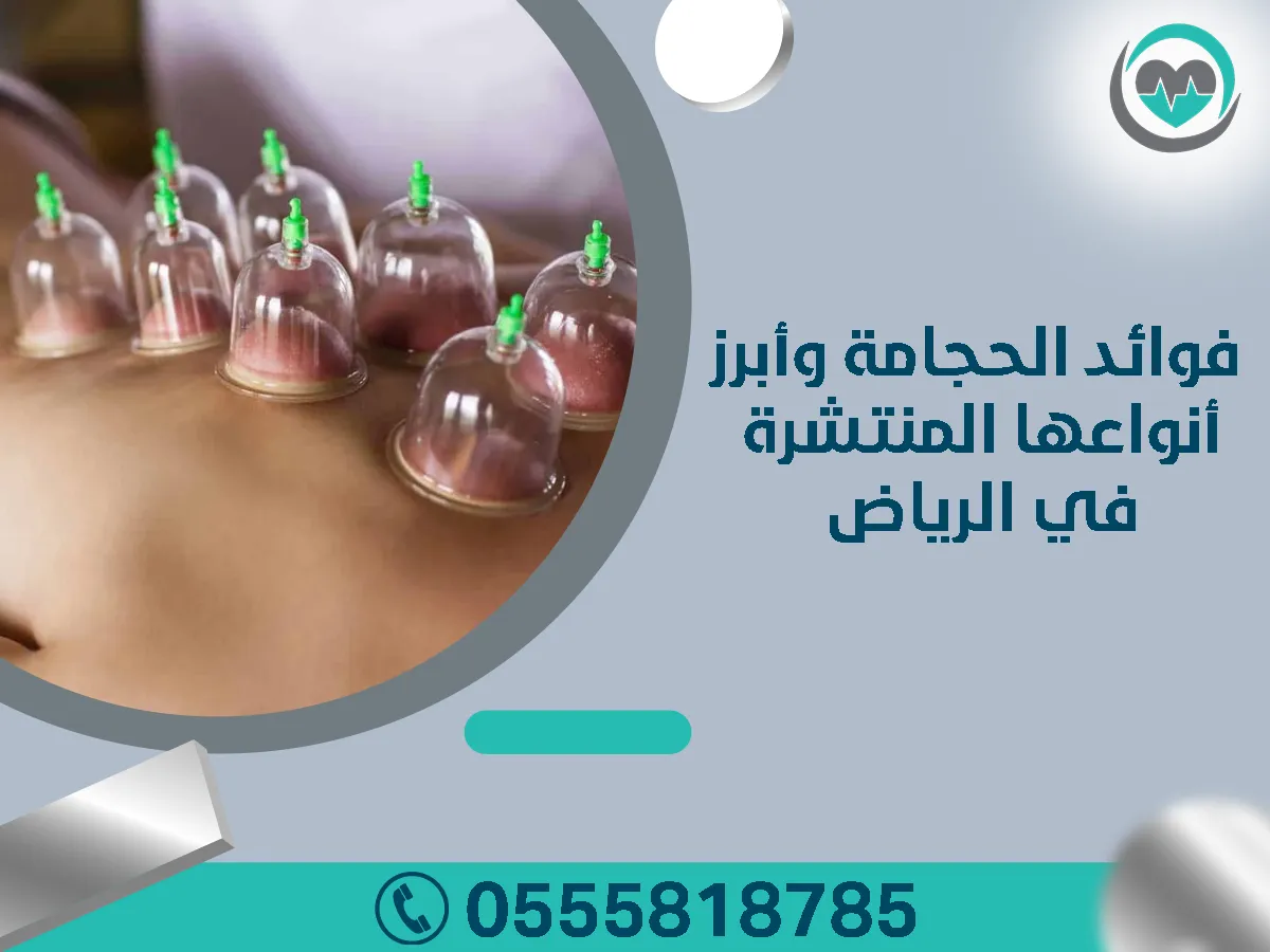 فوائد الحجامة وابرز انواعها المنتشرة في الرياض