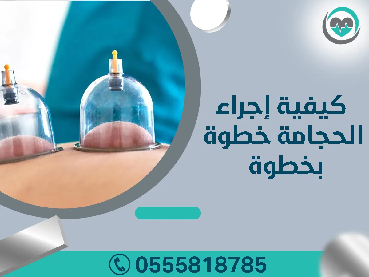 كيفية اجراء الحجامة خطوة بخطوة