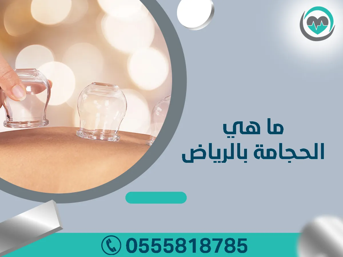 ما هي الحجامة