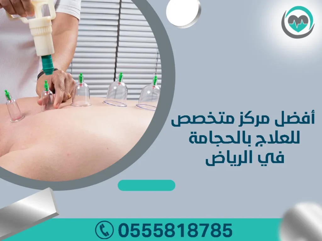 أفضل مركز متخصص للحجامة في الرياض
