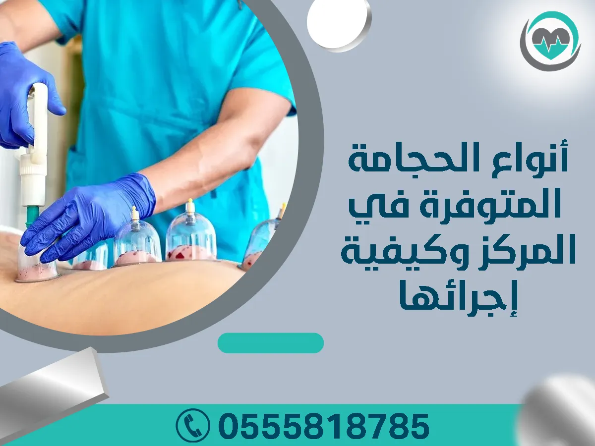 أفضل مركز متخصص للحجامة في الرياض
