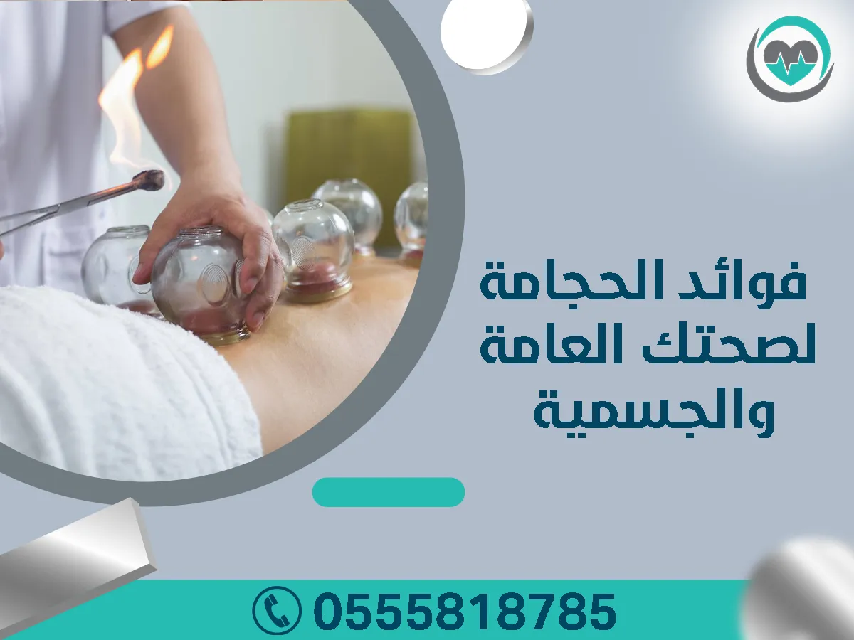 أفضل مركز متخصص للحجامة في الرياض