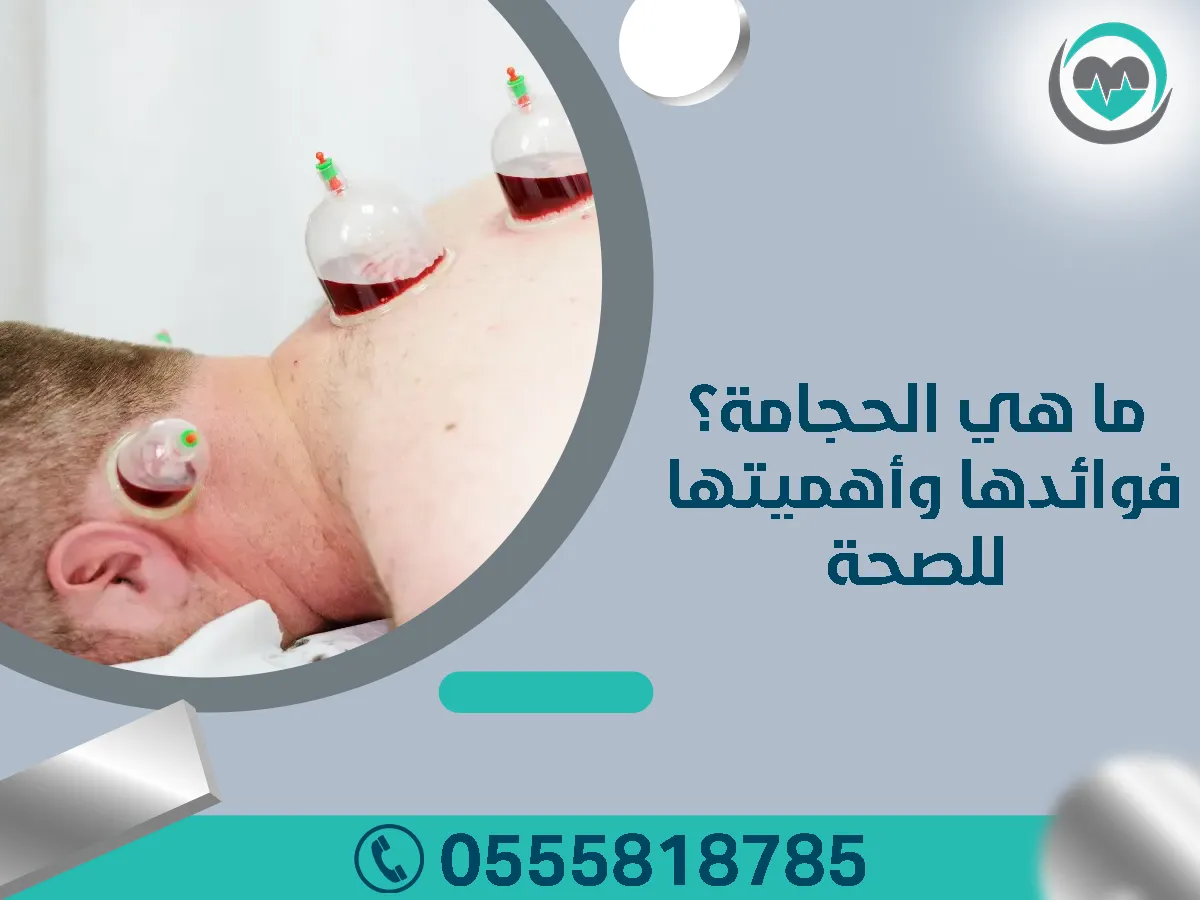 أفضل عيادة للعلاج بالحجامه في الرياض