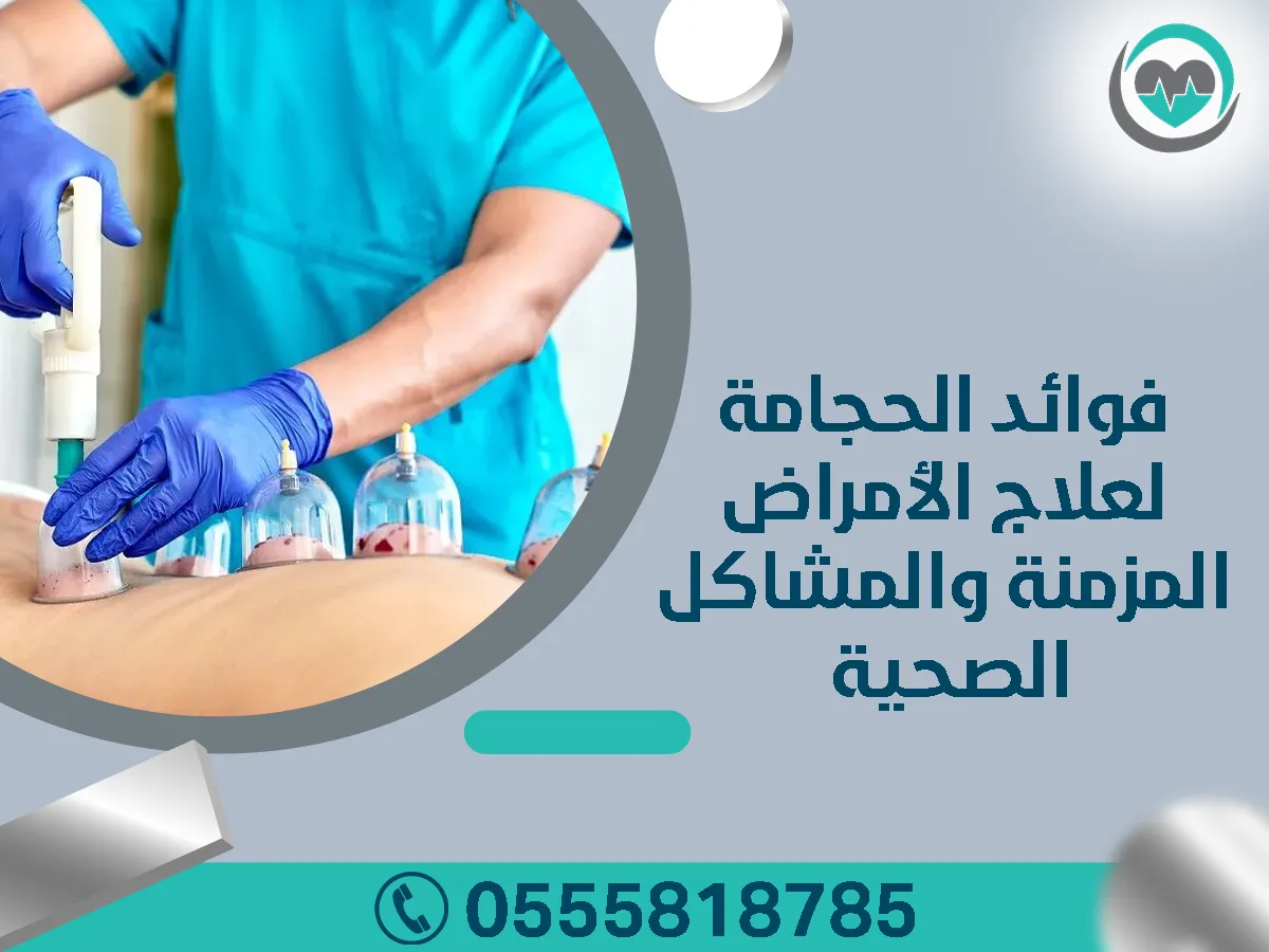 أفضل مركز علاج بالحجامة في الرياض