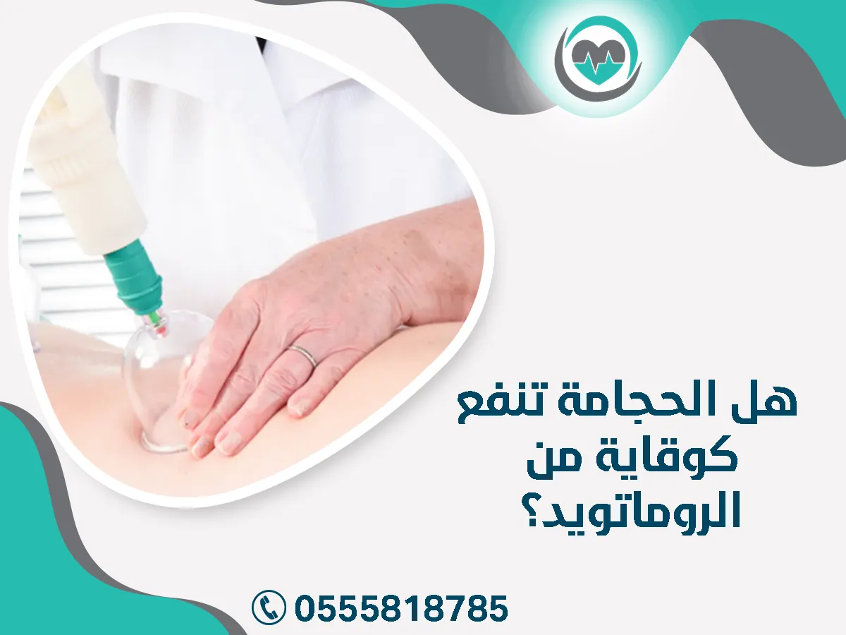 الحجامة تنفع كوقاية من الروماتويد