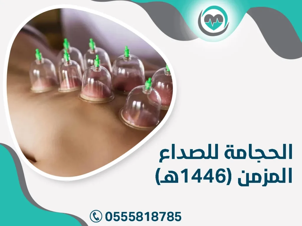 الحجامة للصداع المزمن (1446هـ)