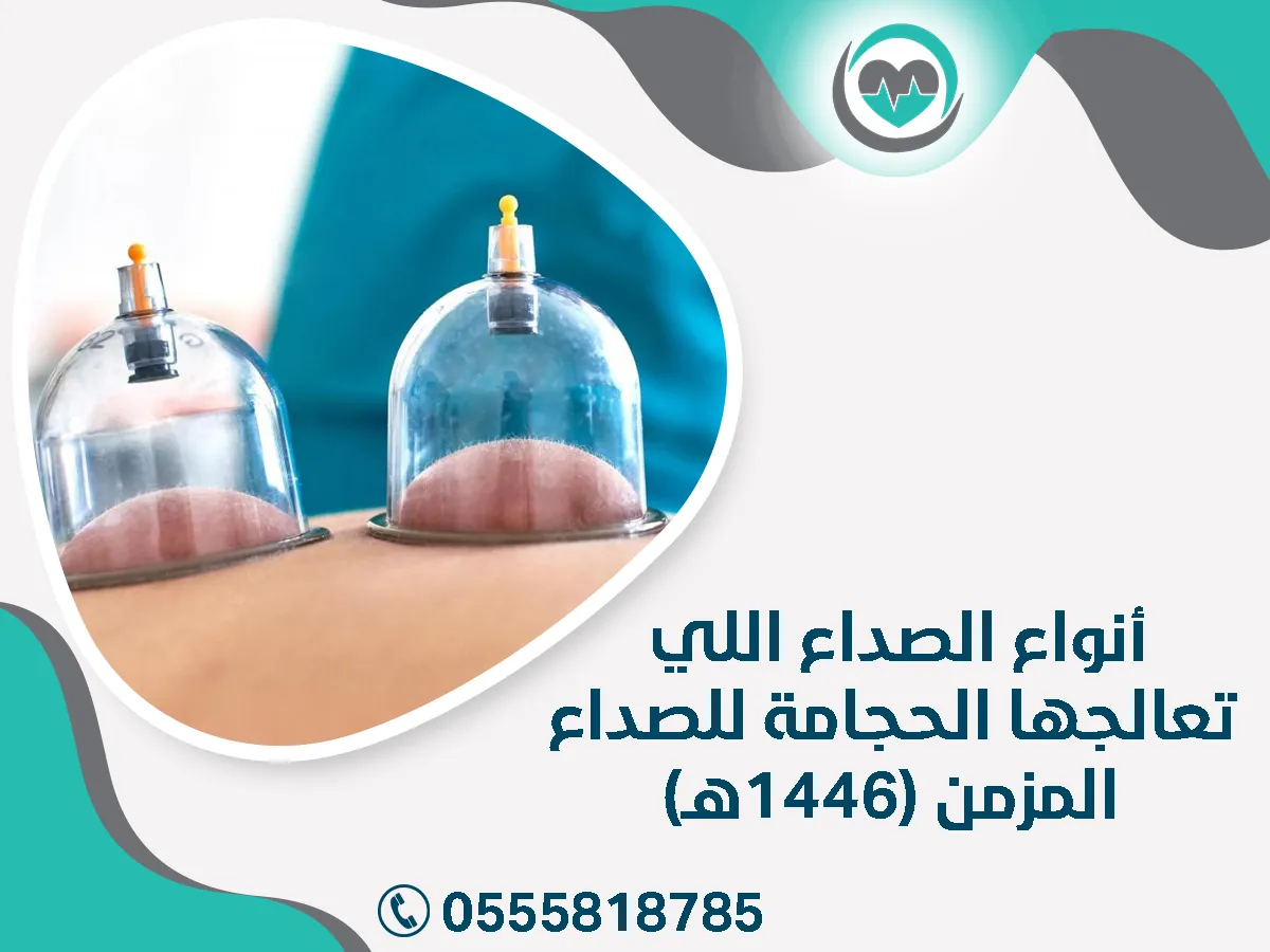 أنواع الصداع اللي تعالجها الحجامة
