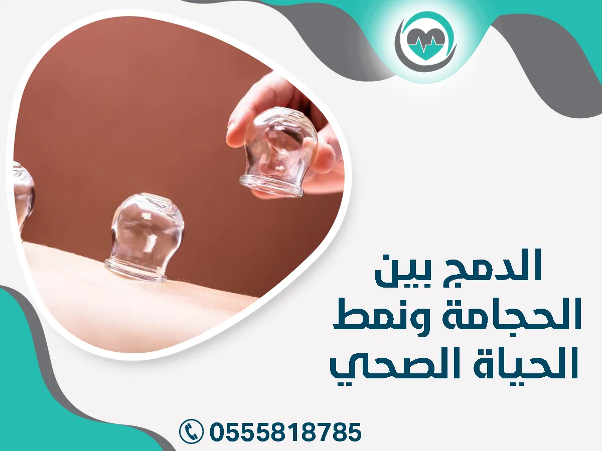 الدمج بين الحجامة ونمط الحياة