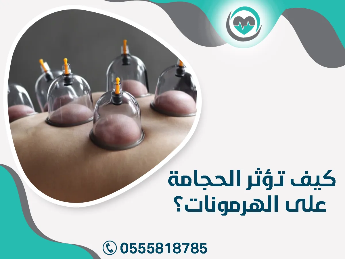 الحجامة والهرمونات