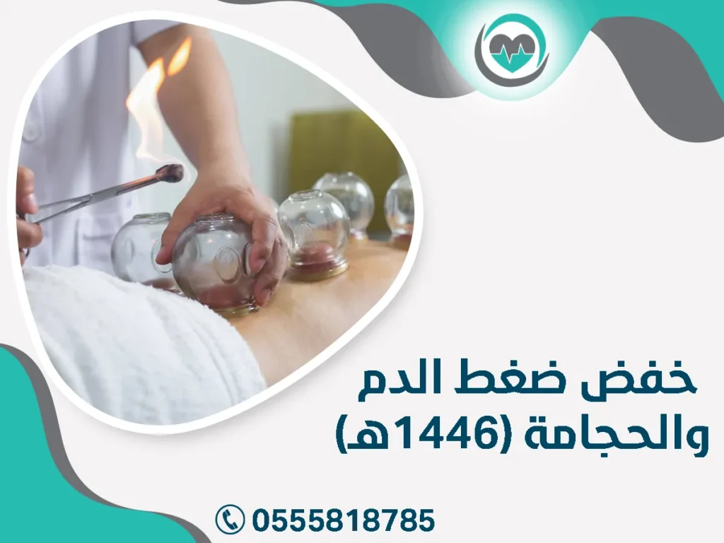 خفض ضغط الدم والحجامة (1446هـ)