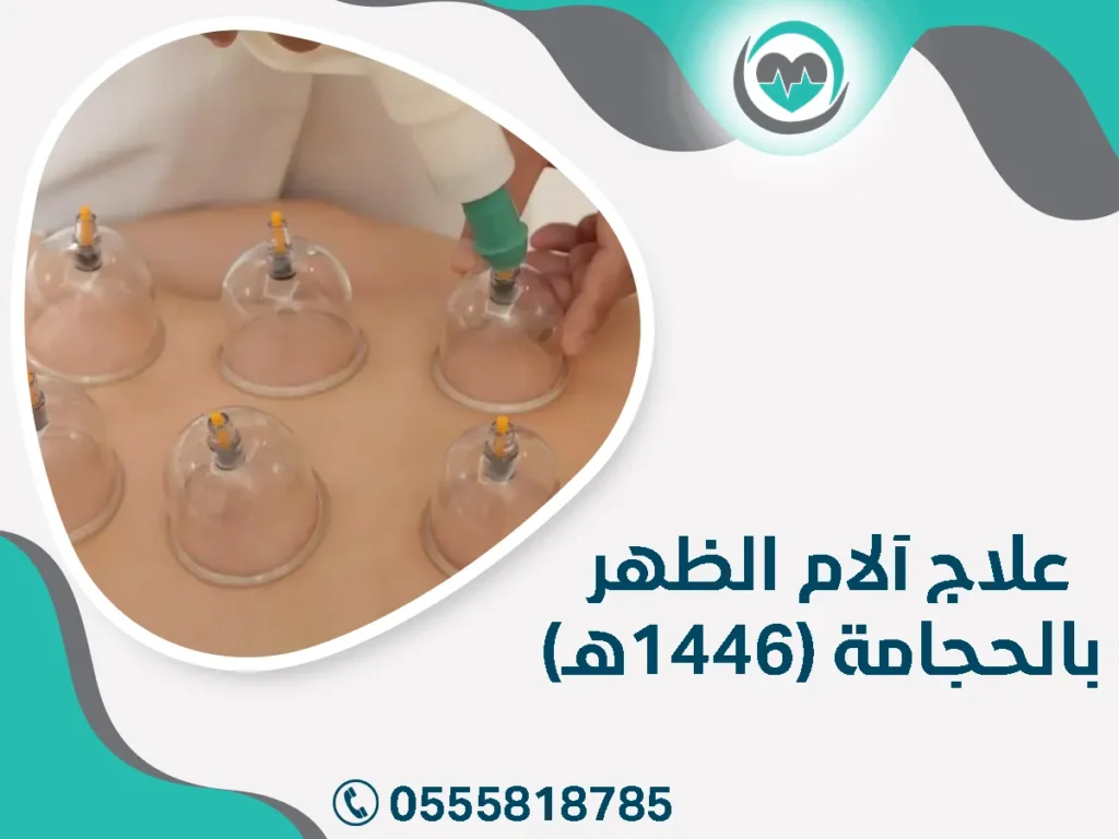 علاج آلام الظهر بالحجامة (1446هـ)