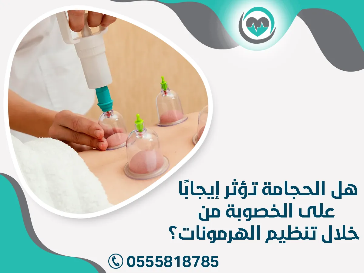هل الحجامة تؤثر إيجابًا على الخصوبة