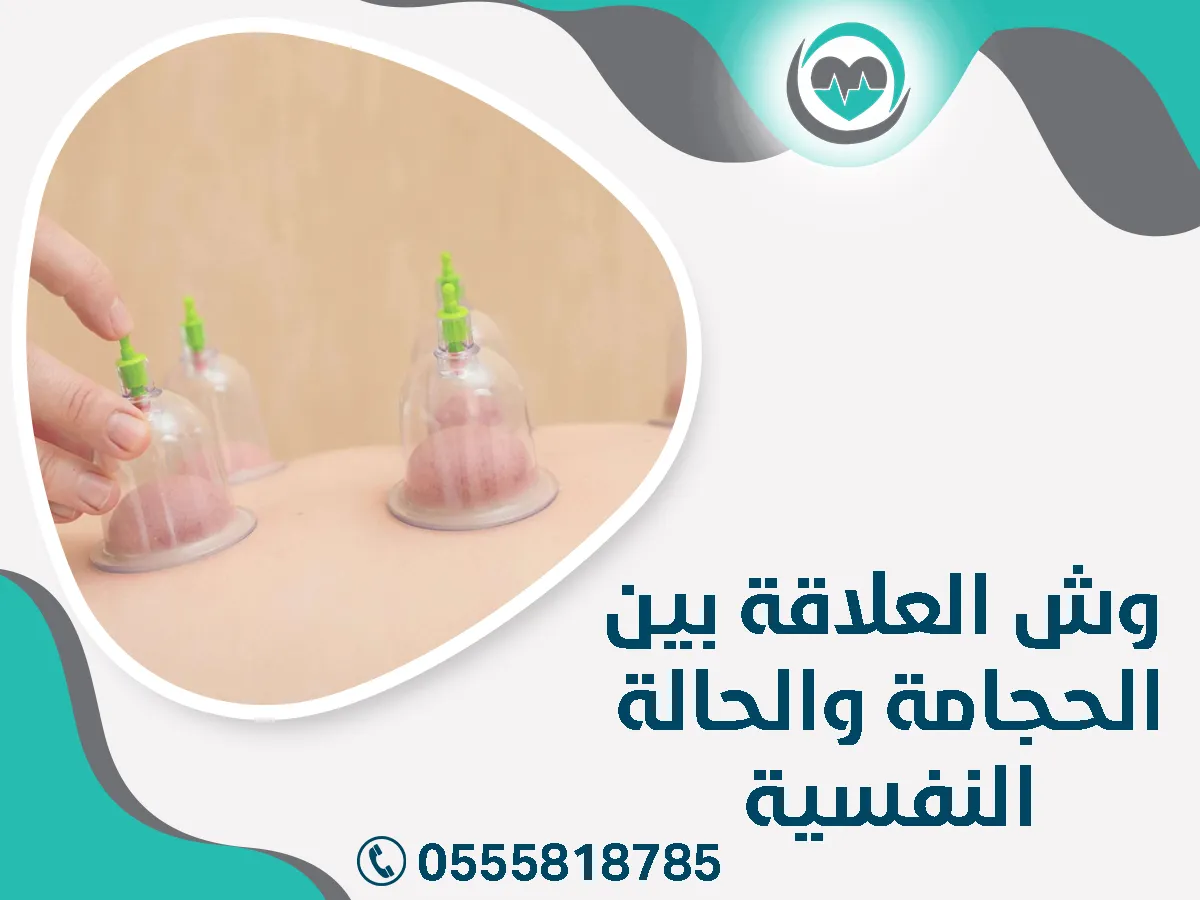 العلاقة بين الحجامة والحالة النفسية