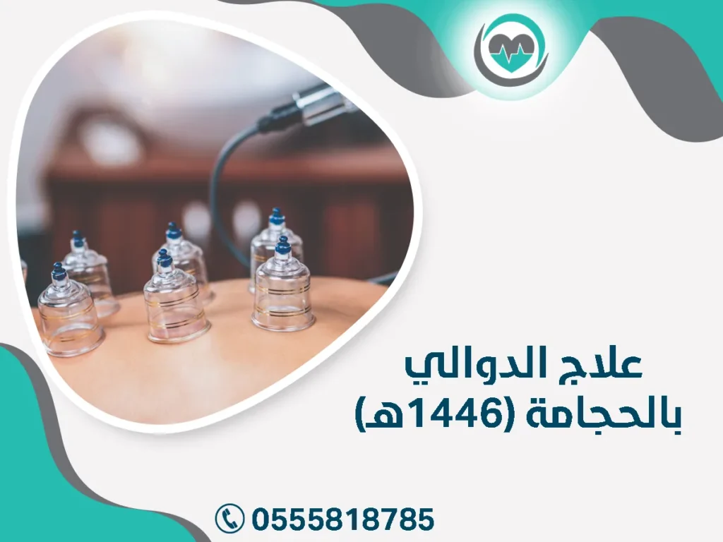 علاج الدوالي بالحجامة (1446هـ)