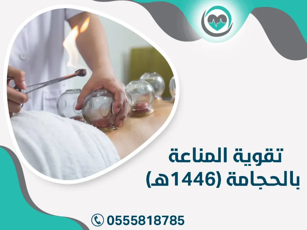 تقوية المناعة بالحجامة (1446هـ)