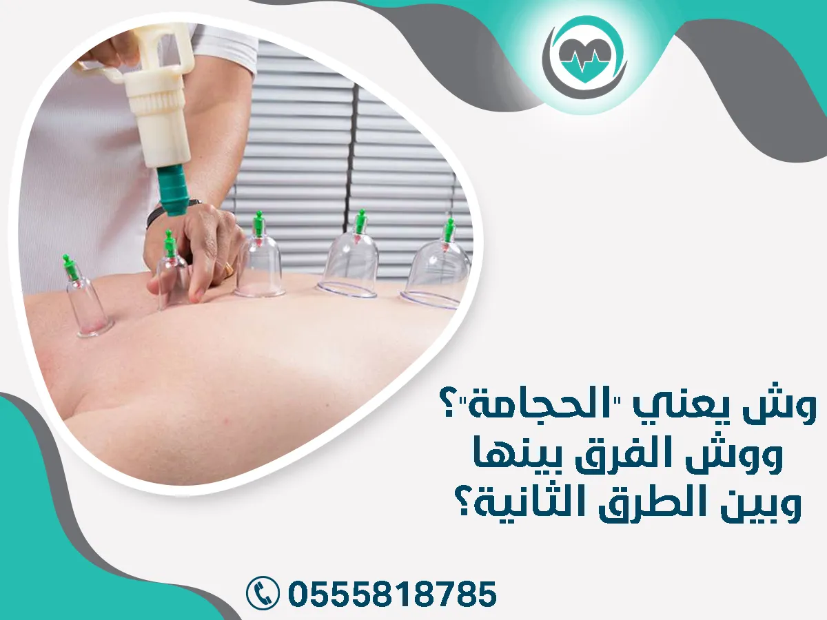 وش يعني "الحجامة"؟