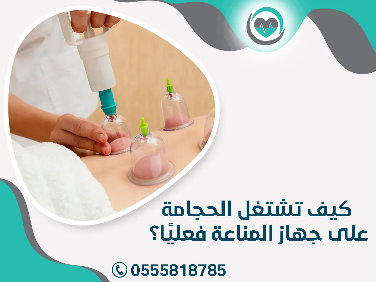 كيف تشتغل الحجامة ؟