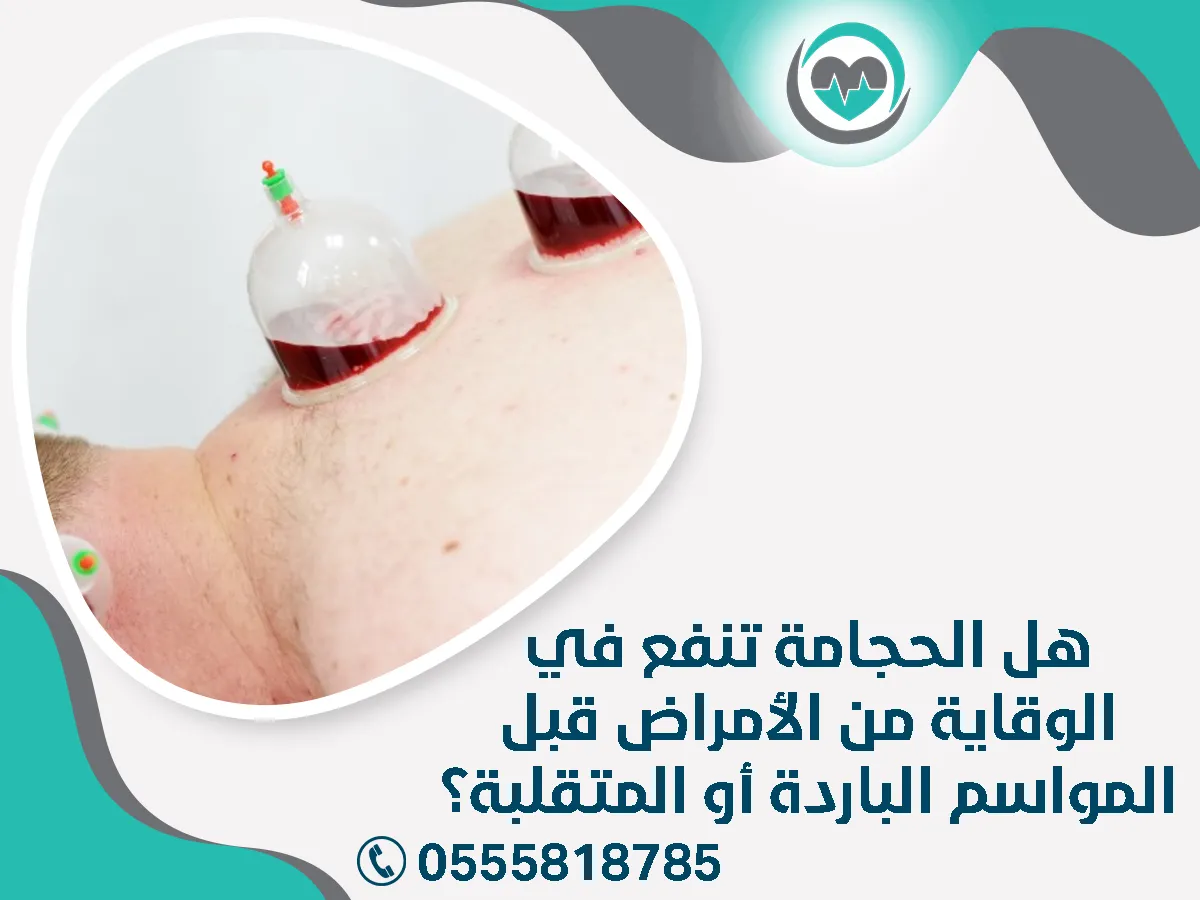الحجامة تنفع في الوقاية من الأمراض قبل المواسم الباردة أو المتقلبة