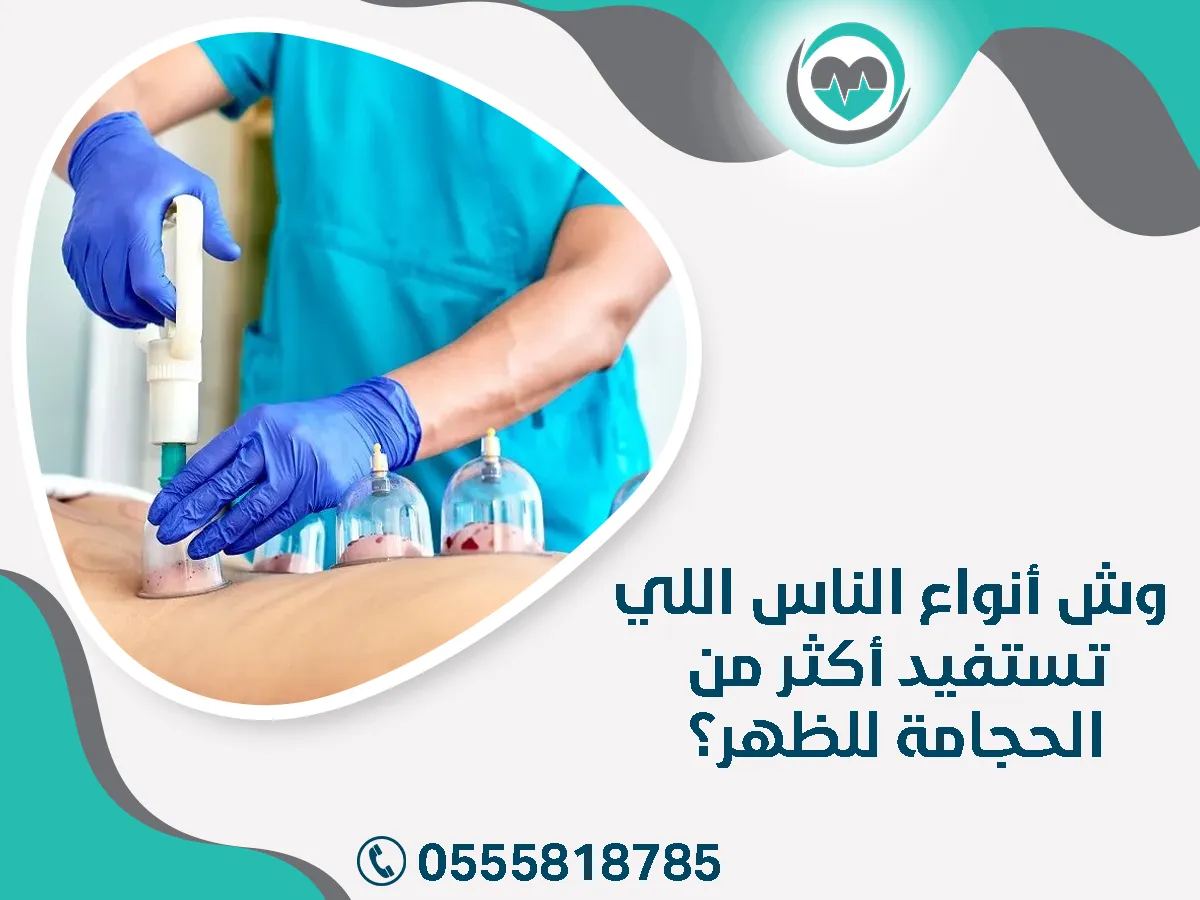وش أنواع الناس اللي تستفيد أكثر من الحجامة