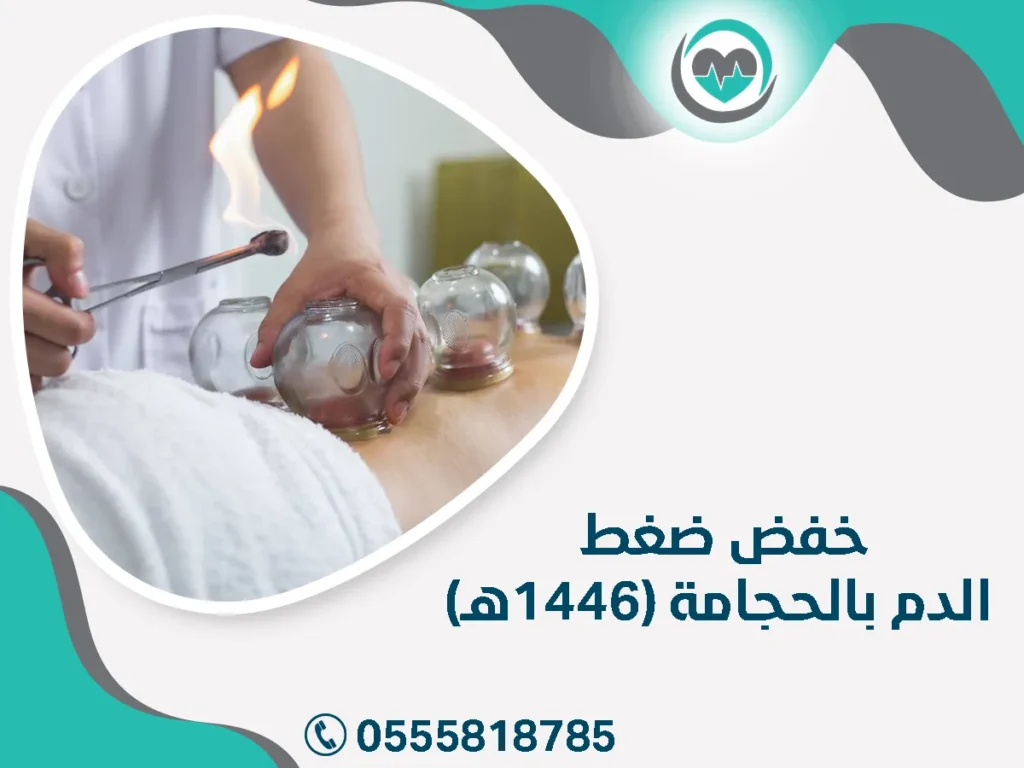 خفض ضغط الدم بالحجامة (1446هـ)