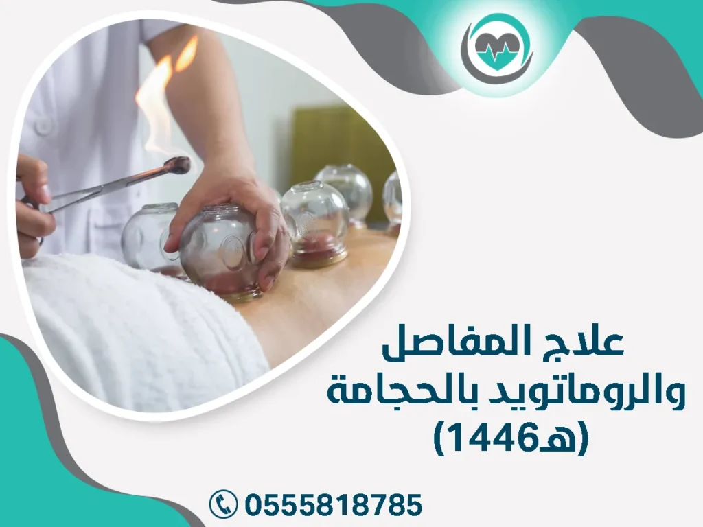 علاج المفاصل والروماتويد بالحجامة (1446هـ)