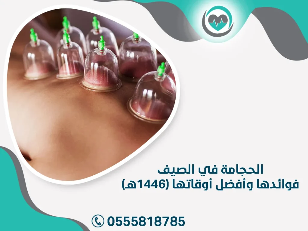 الحجامة في الصيف – فوائدها وأفضل أوقاتها (1446هـ)