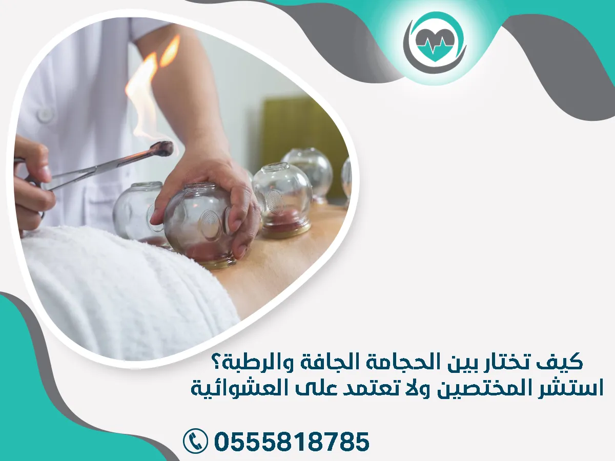 كيف تختار بين الحجامة الجافة والرطبة؟