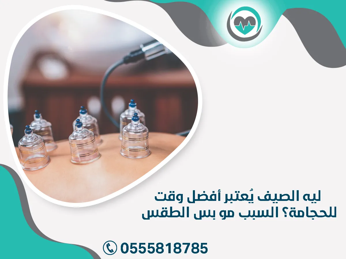 ليه الصيف يُعتبر أفضل وقت للحجامة؟