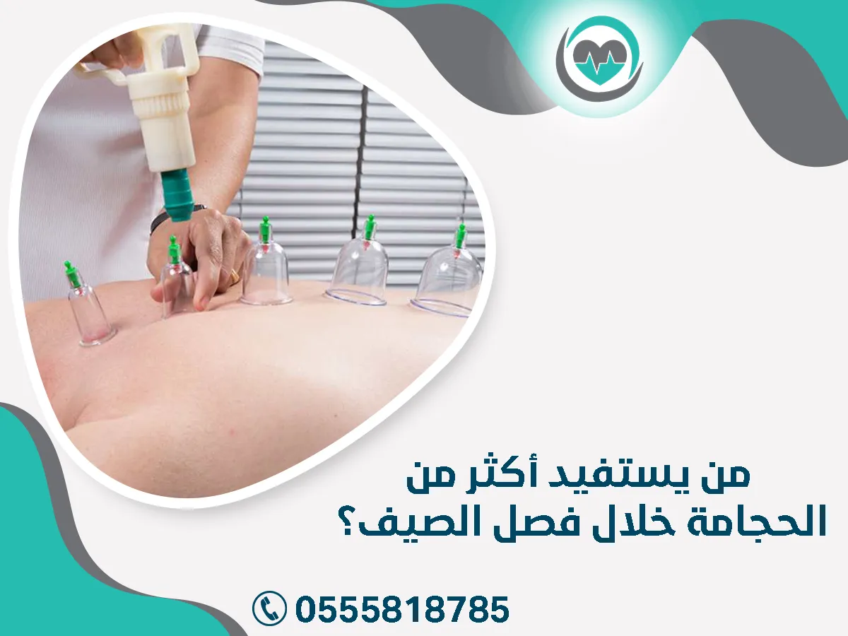 من يستفيد أكثر من الحجامة