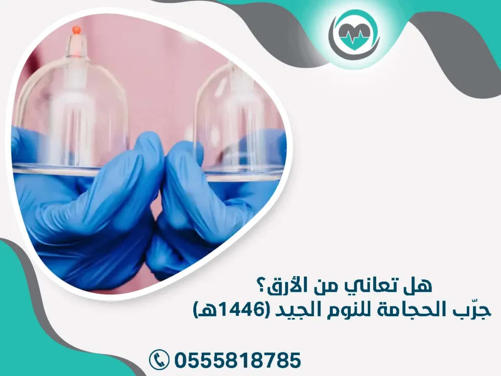 هل تعاني من الأرق؟ جرّب الحجامة للنوم الجيد (1446هـ)