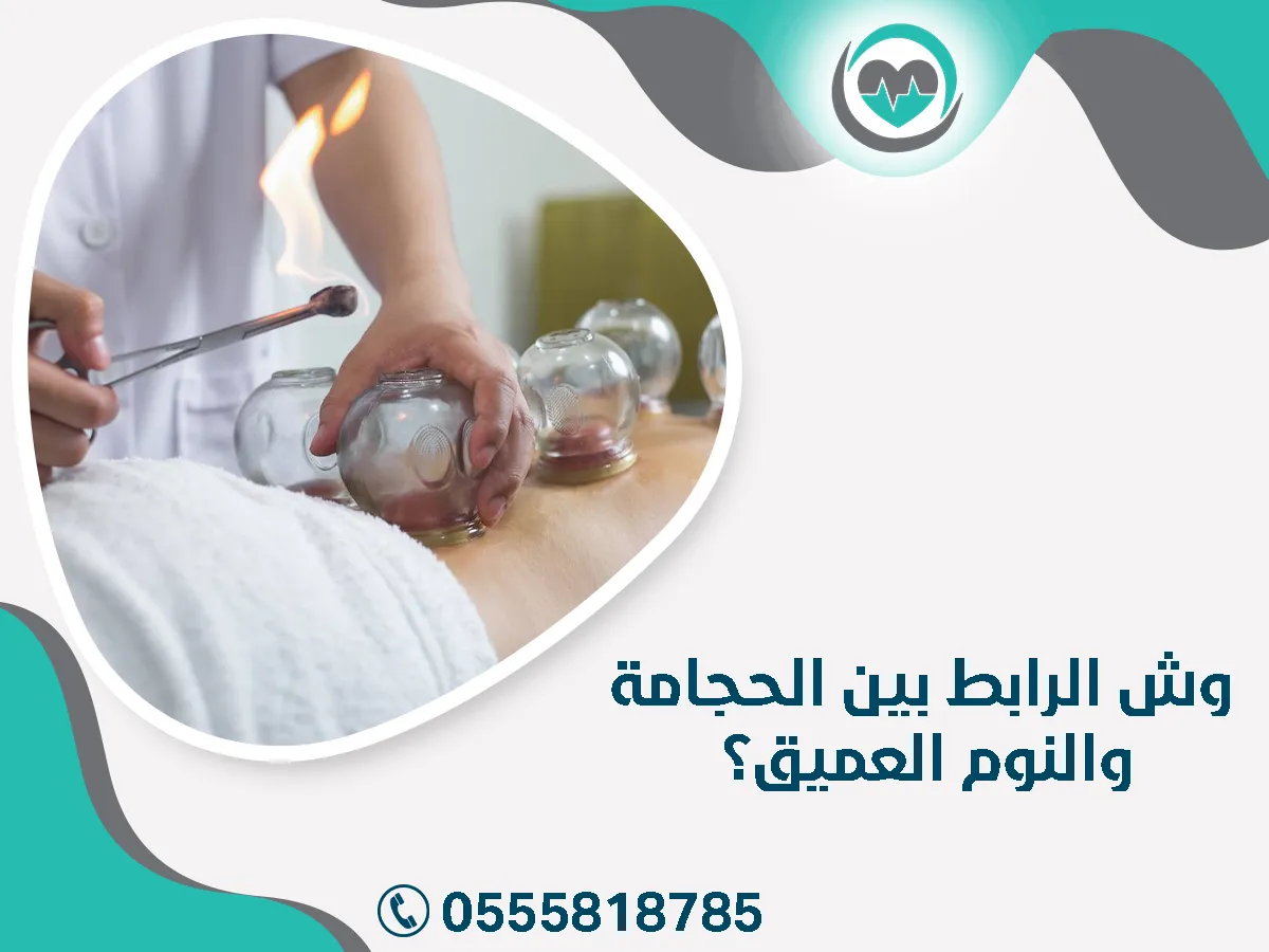 وش الرابط بين الحجامة والنوم