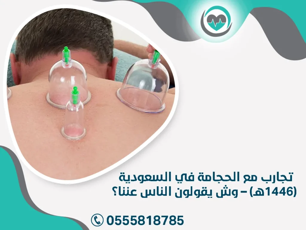 تجارب مع الحجامة في السعودية (1446هـ) – وش يقولون الناس عننا؟