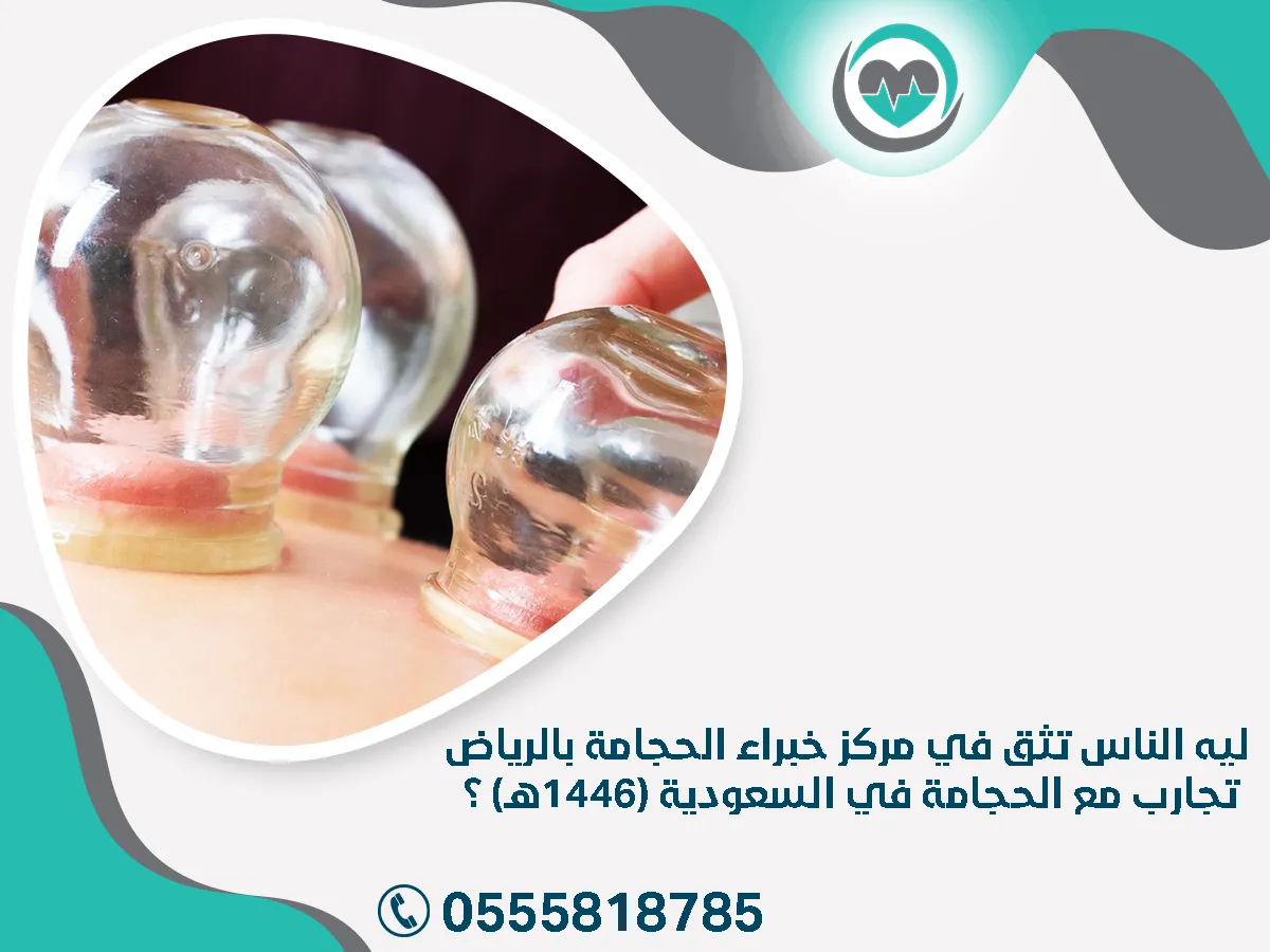 ليه الناس تثق في مركز خبراء الحجامة بالرياض 