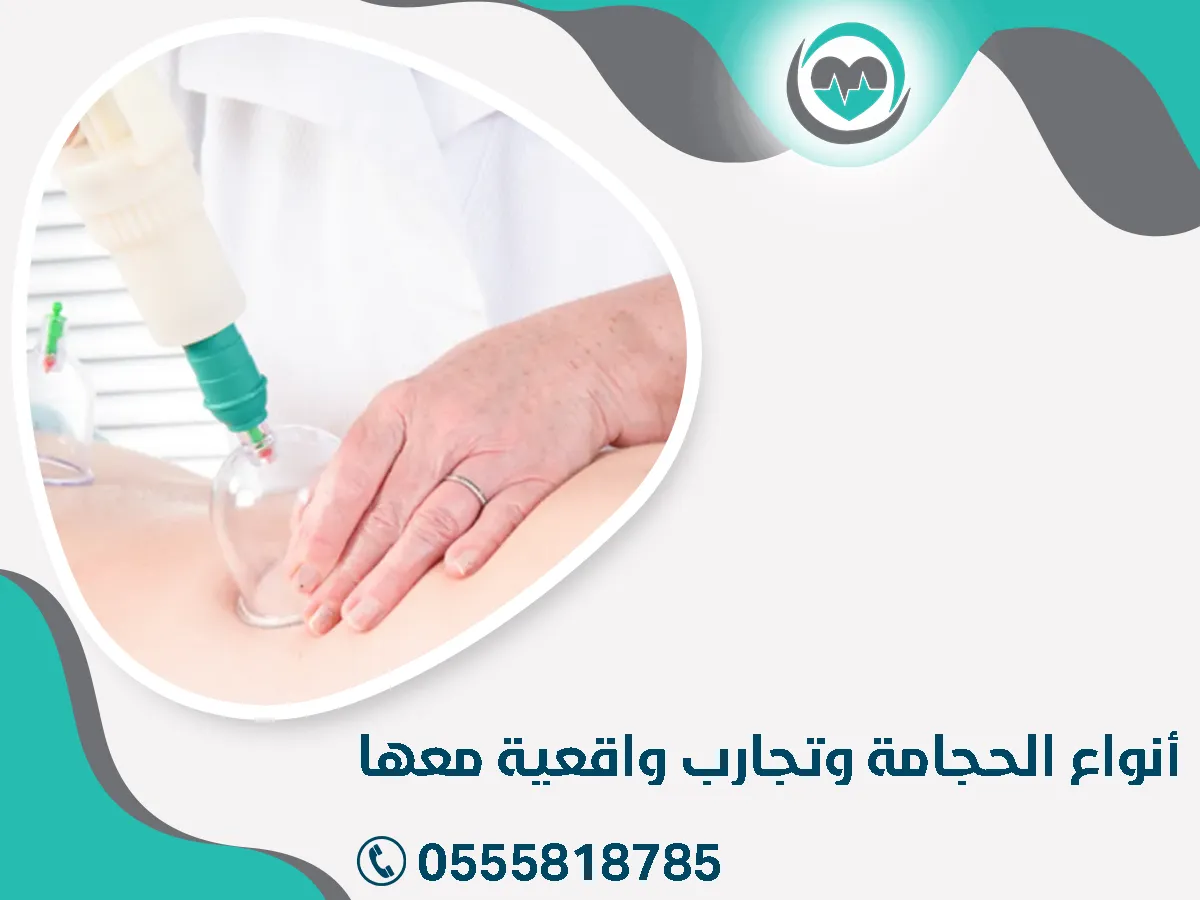 أنواع الحجامة 