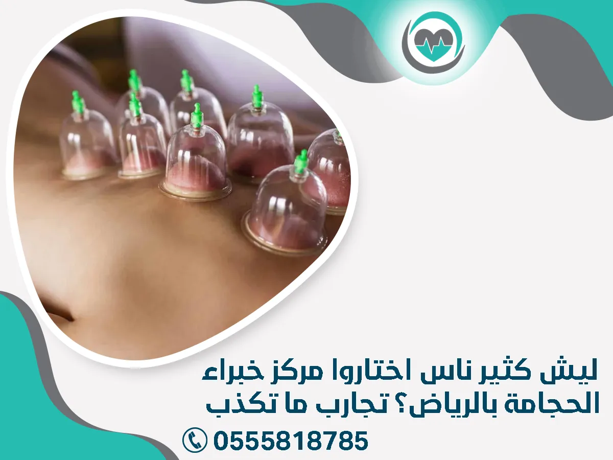 ليش كثير ناس اختاروا مركز خبراء الحجامة بالرياض؟