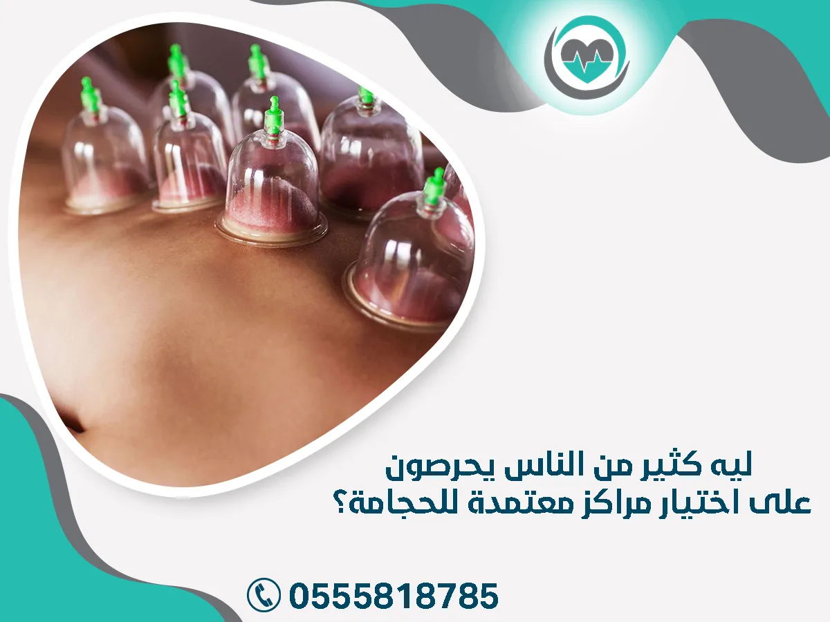 ليه كثير من الناس يحرصون على اختيار مراكز للحجامة