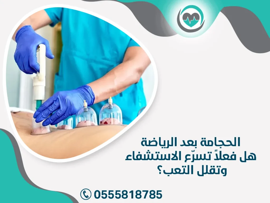 الحجامة بعد الرياضة – هل فعلاً تسرّع الاستشفاء وتقلل التعب؟