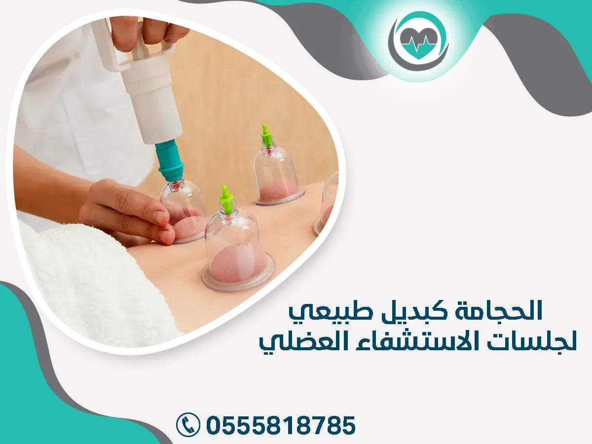 الحجامة كبديل طبيعي لجلسات الاستشفاء