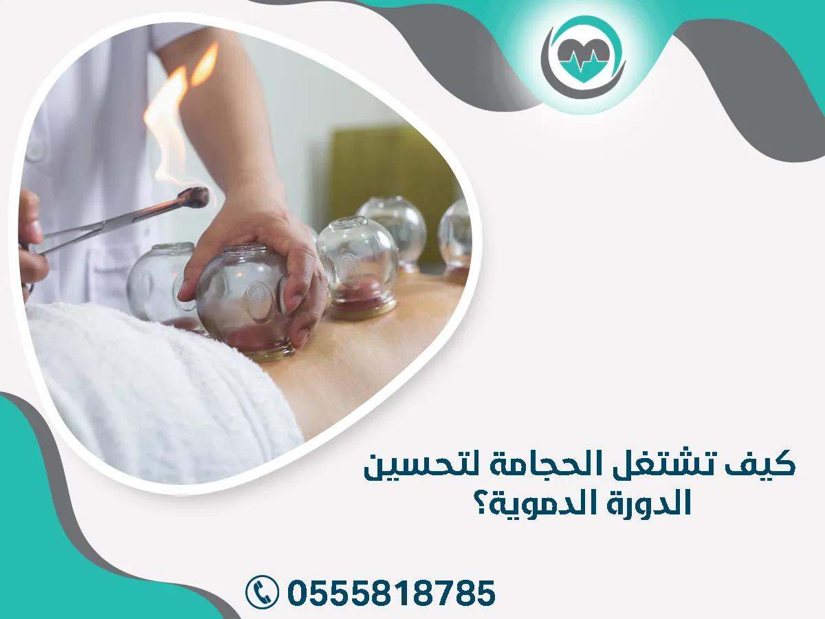 تشتغل الحجامة لتحسين الدورة الدموية