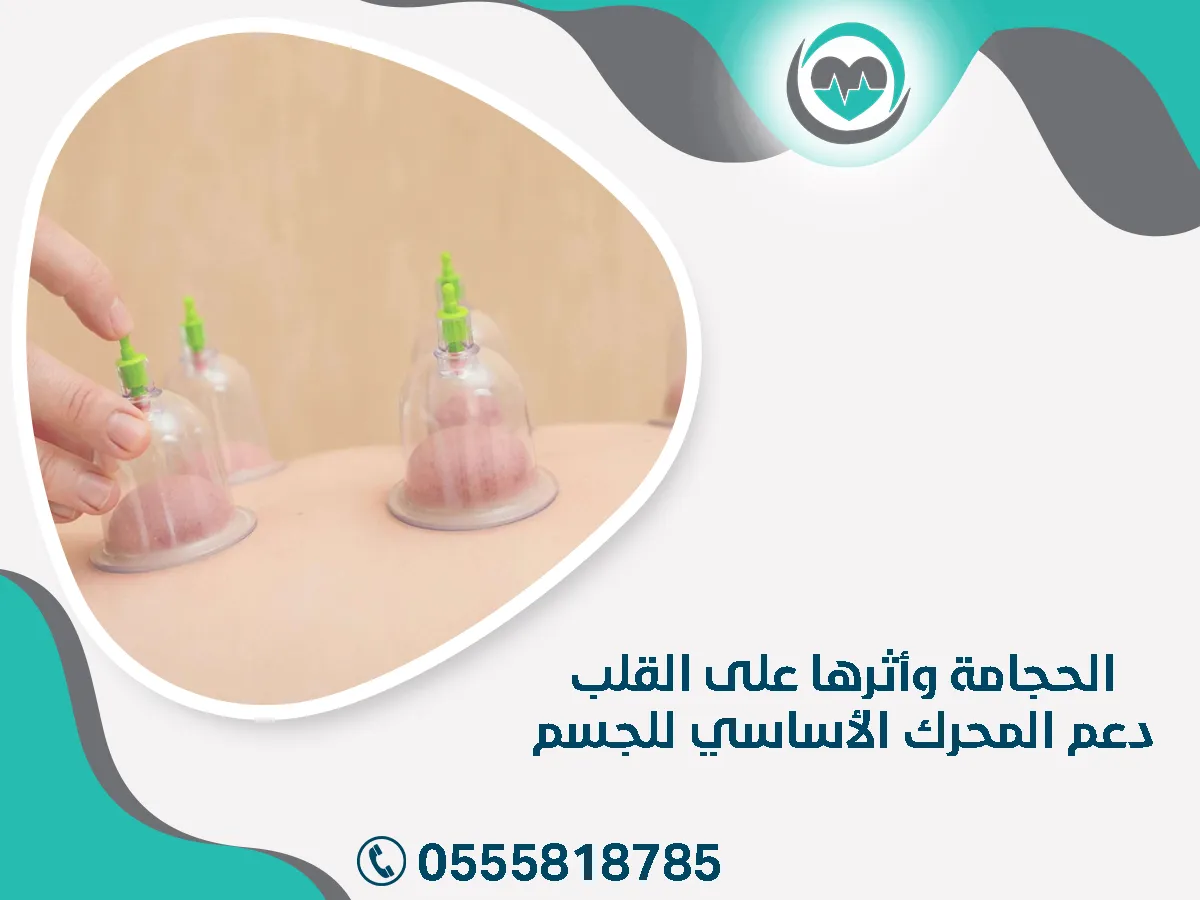 الحجامة وأثرها على القلب