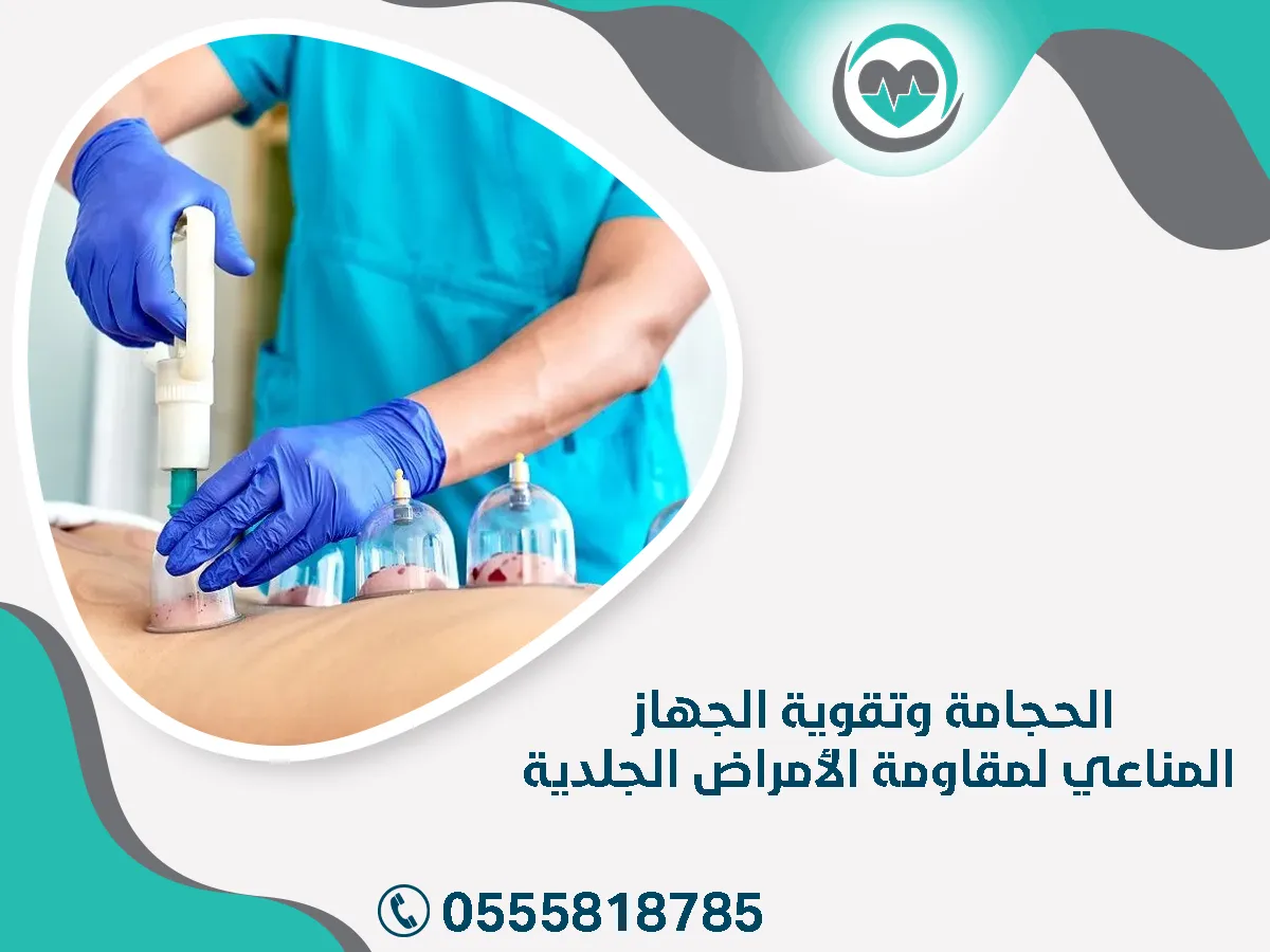 الحجامة وتقوية الجهاز المناعي لمقاومة الأمراض 
