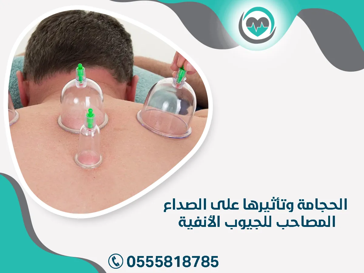 الحجامة وتأثيرها على الصداع