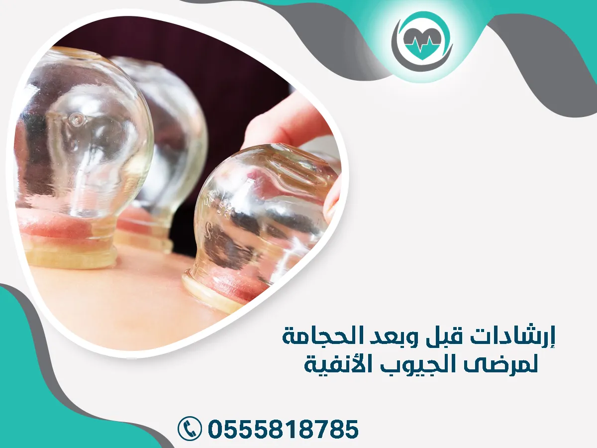 إرشادات قبل الحجامة لمرضى الجيوب الأنفية